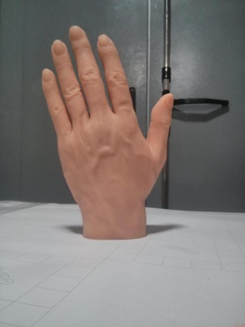 假肢廠家安裝手指假肢時要注意哪些問題(圖1) 假肢廠家安裝手指假肢時要注意哪些問題(圖1)