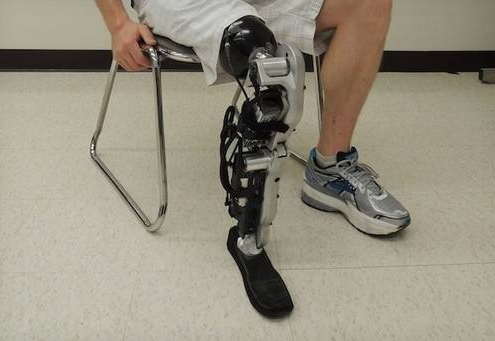 如何理性對待避免安裝劣質假肢?(圖1) 假肢