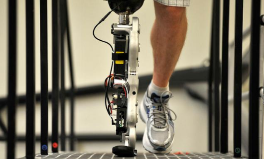 假肢廠家淺談購(gòu)買(mǎi)假肢常見(jiàn)的幾大誤區(qū)(圖1) 假肢